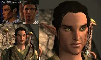 modalImage