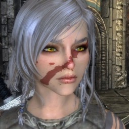 modalImage